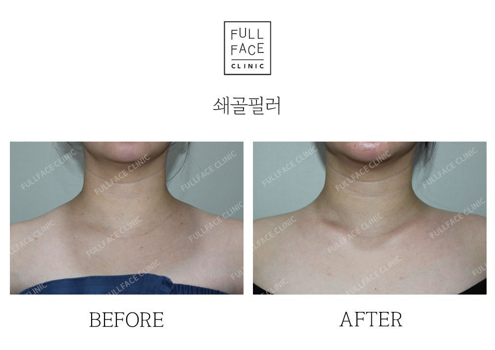 Filler