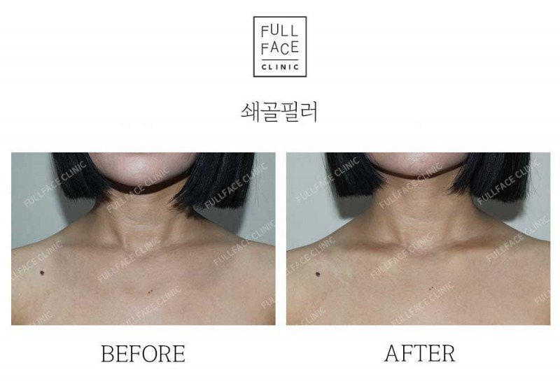 Filler