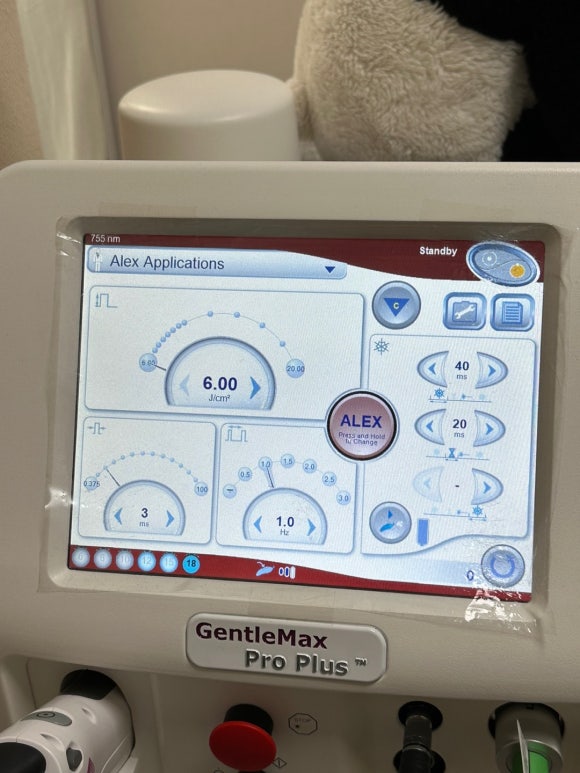 홍대 인중제모, 겨드랑이제모 젠틀맥스프로플러스  횟수, 주기